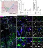 Cerebellin 4 Antibody in Immunohistochemistry (IHC)