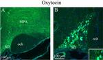 Oxytocin Antibody in Immunohistochemistry (IHC)
