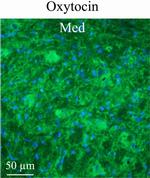 Oxytocin Antibody in Immunohistochemistry (IHC)