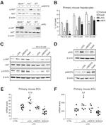 Phospho-Axl (Tyr691) Antibody in Western Blot (WB)