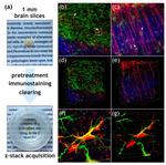GFAP Antibody in Immunohistochemistry, Immunocytochemistry (IHC, ICC/IF)