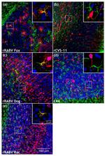 GFAP Antibody in Immunohistochemistry (IHC)