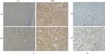KIF15 Antibody in Immunohistochemistry (IHC)