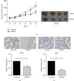 KIF15 Antibody in Immunohistochemistry (IHC)
