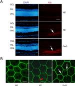 Rat Albumin Antibody in Immunohistochemistry (IHC)