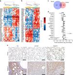 SERPINH1 Antibody in Immunohistochemistry (IHC)