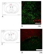 beta Amyloid Antibody in Immunohistochemistry, Immunocytochemistry (IHC, ICC/IF)