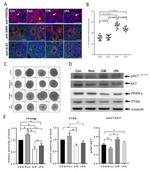 FOXO3A Antibody in Immunohistochemistry, Immunocytochemistry (IHC, ICC/IF)