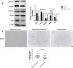POTEF Antibody in Western Blot (WB)