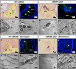 Staphylococcus aureus Antibody in Immunohistochemistry, Immunohistochemistry (Paraffin) (IHC, IHC (P))