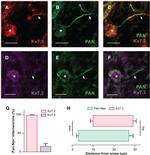 KCNQ2 Antibody in Immunohistochemistry, Immunocytochemistry (IHC, ICC/IF)