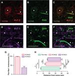 KCNQ2 Antibody in Immunohistochemistry, Immunocytochemistry (IHC, ICC/IF)