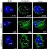 Cytokeratin 18 Antibody in Immunocytochemistry (ICC/IF)