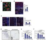 PDGFRA Antibody in Immunohistochemistry (Paraffin) (IHC (P))