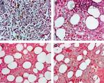 Neuropilin 1 Antibody in Immunohistochemistry (Paraffin) (IHC (P))