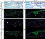 CD31 Antibody in Immunohistochemistry (IHC)