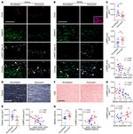 CD45 Antibody in Immunohistochemistry (IHC)