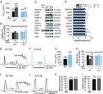 CACNA2D1 Antibody in Western Blot (WB)