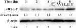 Phospho-EIF2S1 (Ser52) Antibody in Western Blot (WB)