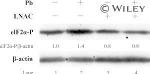 Phospho-EIF2S1 (Ser52) Antibody in Western Blot (WB)