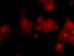 turboGFP Antibody in Immunocytochemistry (ICC/IF)