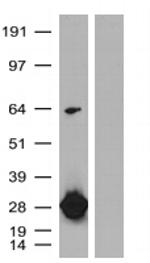 turboGFP Antibody in Western Blot (WB)