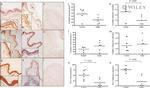 Occludin Antibody in Immunohistochemistry (Paraffin) (IHC (P))