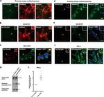 Tau Antibody in Western Blot (WB)
