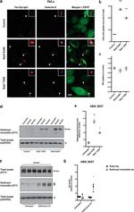 Tau Antibody in Western Blot (WB)