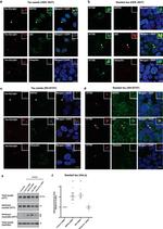 Tau Antibody in Western Blot (WB)