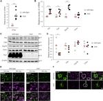 PDI Antibody in Immunocytochemistry (ICC/IF)
