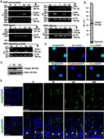 N-cadherin Antibody in Immunohistochemistry (IHC)