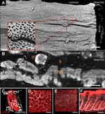 E-cadherin Antibody in Immunohistochemistry (Paraffin) (IHC (P))