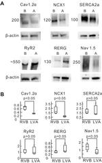 Sodium/Calcium Exchanger Antibody in Western Blot (WB)