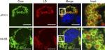 Hepatitis C Virus Core Antigen Antibody in Immunocytochemistry (ICC/IF)