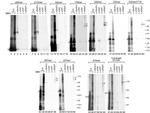 Calreticulin Antibody in Immunoprecipitation (IP)