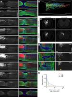 GFAP Antibody in Immunohistochemistry (IHC)