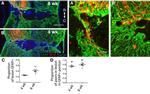 GFAP Antibody in Immunohistochemistry (IHC)