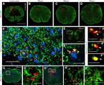 GFAP Antibody in Immunohistochemistry (IHC)