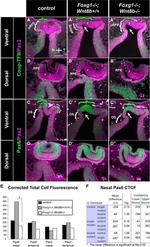 PAX2 Antibody in Immunohistochemistry (IHC)