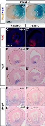 PAX2 Antibody in Immunohistochemistry (IHC)