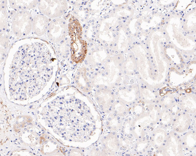 Caveolin-1 Antibody in Immunohistochemistry (Paraffin) (IHC (P))