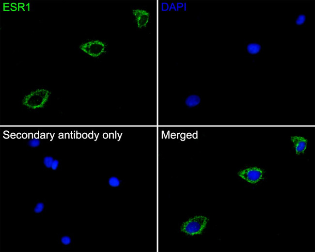 ESR1 Antibody in Immunocytochemistry (ICC/IF)