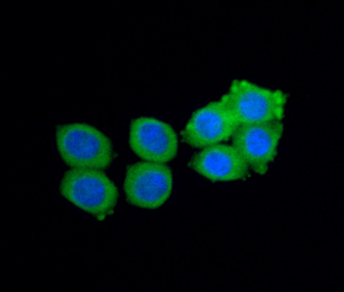 Noggin Antibody in Immunocytochemistry (ICC/IF)
