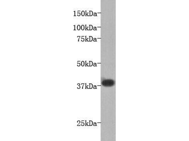 LPA receptor 1 Antibody in Western Blot (WB)