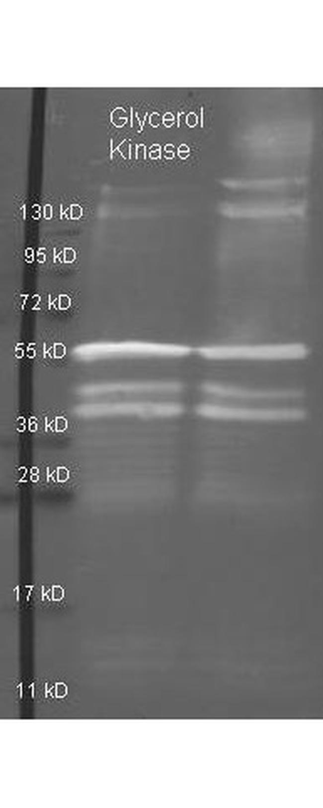 Glycerol Kinase Antibody in Western Blot (WB)