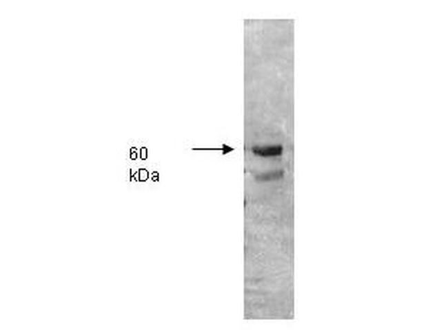 Alkaline Phosphatase Antibody in Western Blot (WB)