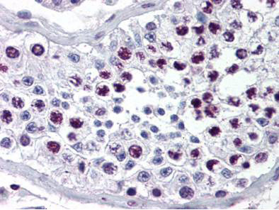 Cyclin A Antibody in Immunohistochemistry (Paraffin) (IHC (P))