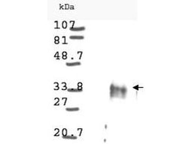 Cyclin D1 Antibody in Western Blot (WB)