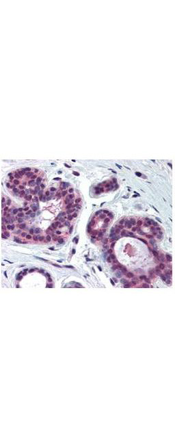 cdk2 Antibody in Immunohistochemistry (Paraffin) (IHC (P))